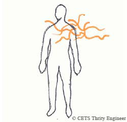 コヒーレントではない状態